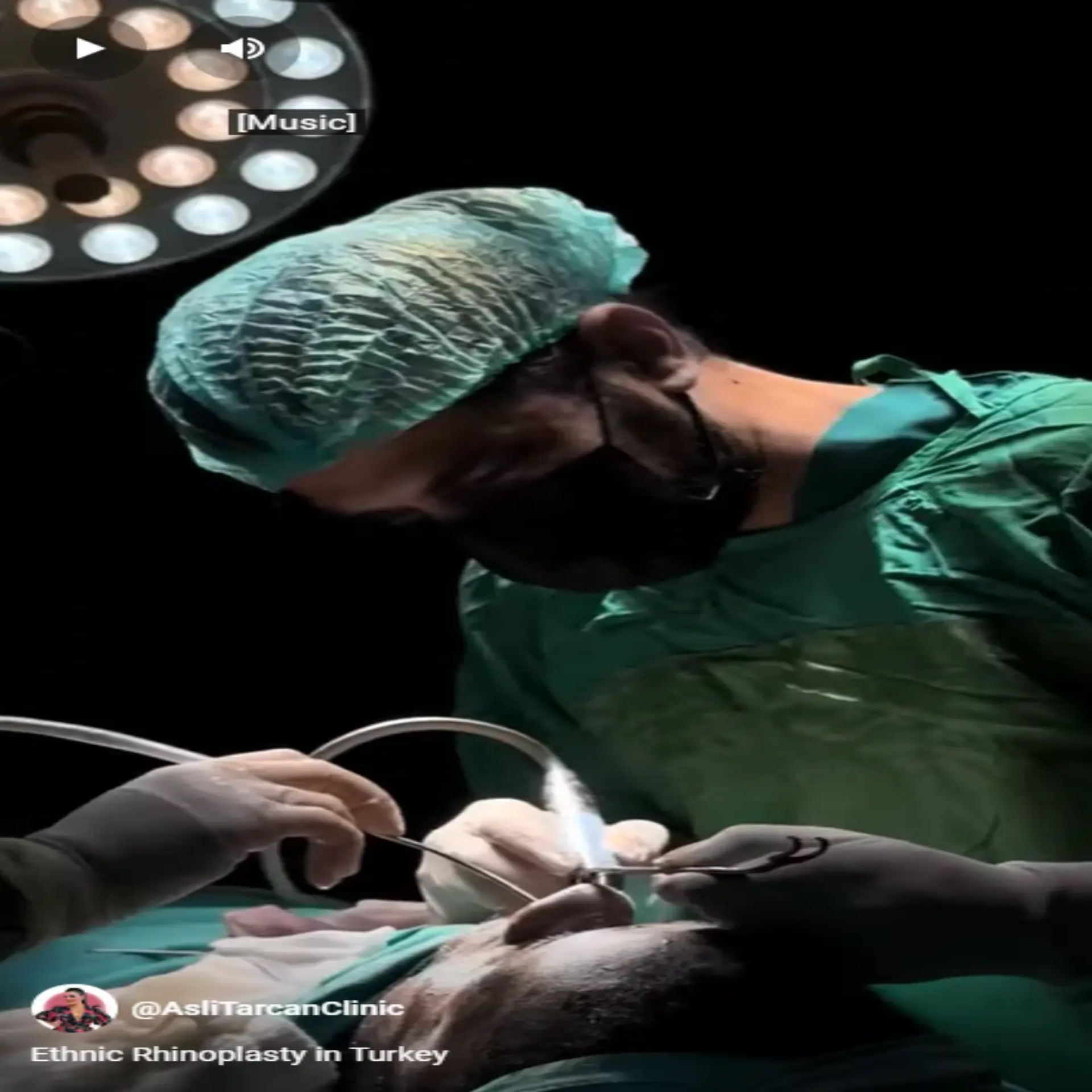 Ethnic rhinoplasty cost