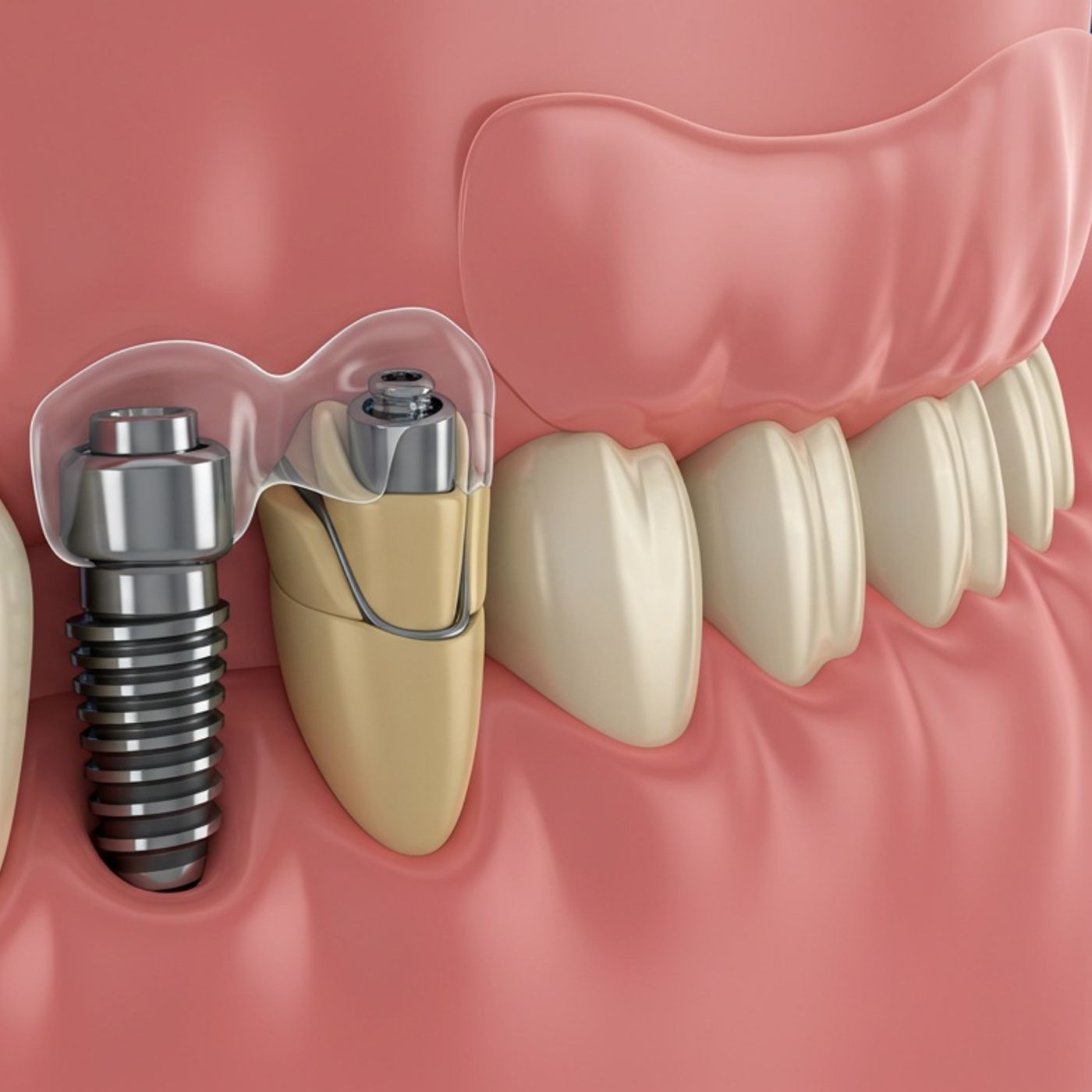 Smile Talks: Confident Oral Health