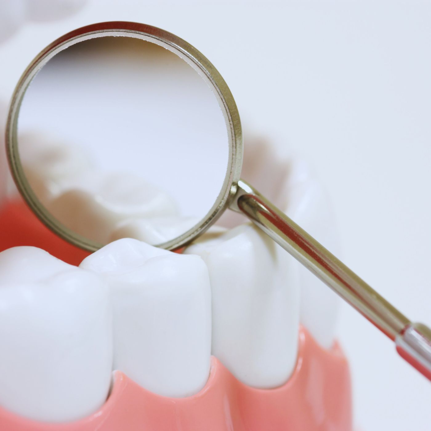7 Reasons You Should Never Skip Your Dental Check-Up